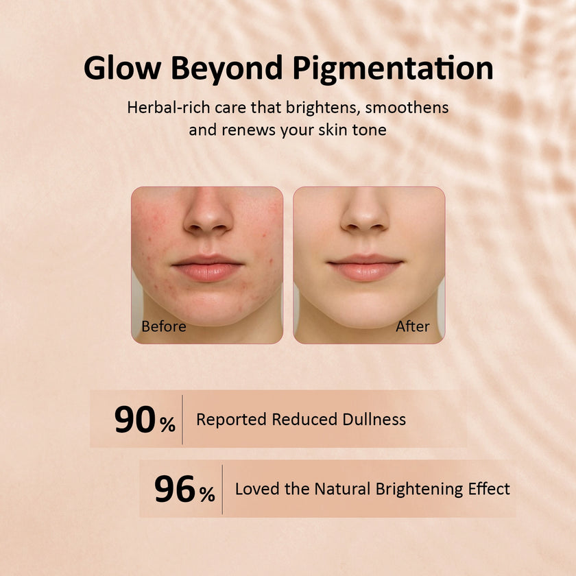 CareVeda Tone & Glow Anti Pigmentation Sheet Mask Suitable For All Skin Types, 25gm