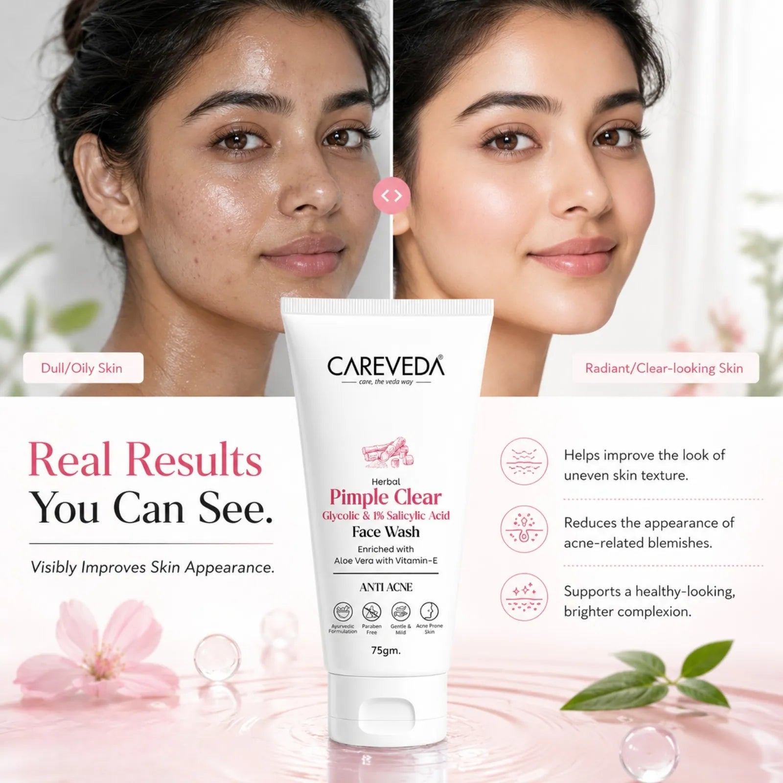 CareVeda Herbal Pimple Clear Face Wash with 1% Salicylic & Glycolic Acid - 75gm