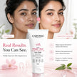 CareVeda Herbal Pimple Clear Face Wash with 1% Salicylic & Glycolic Acid - 75gm