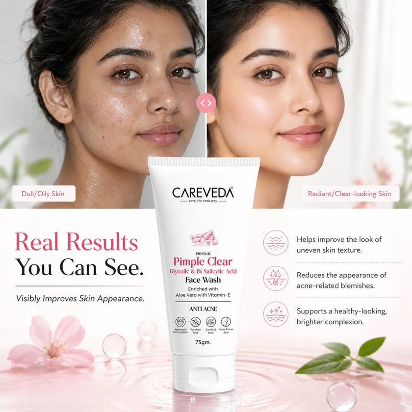 CareVeda Herbal Pimple Clear Face Wash with 1% Salicylic & Glycolic Acid - 75gm