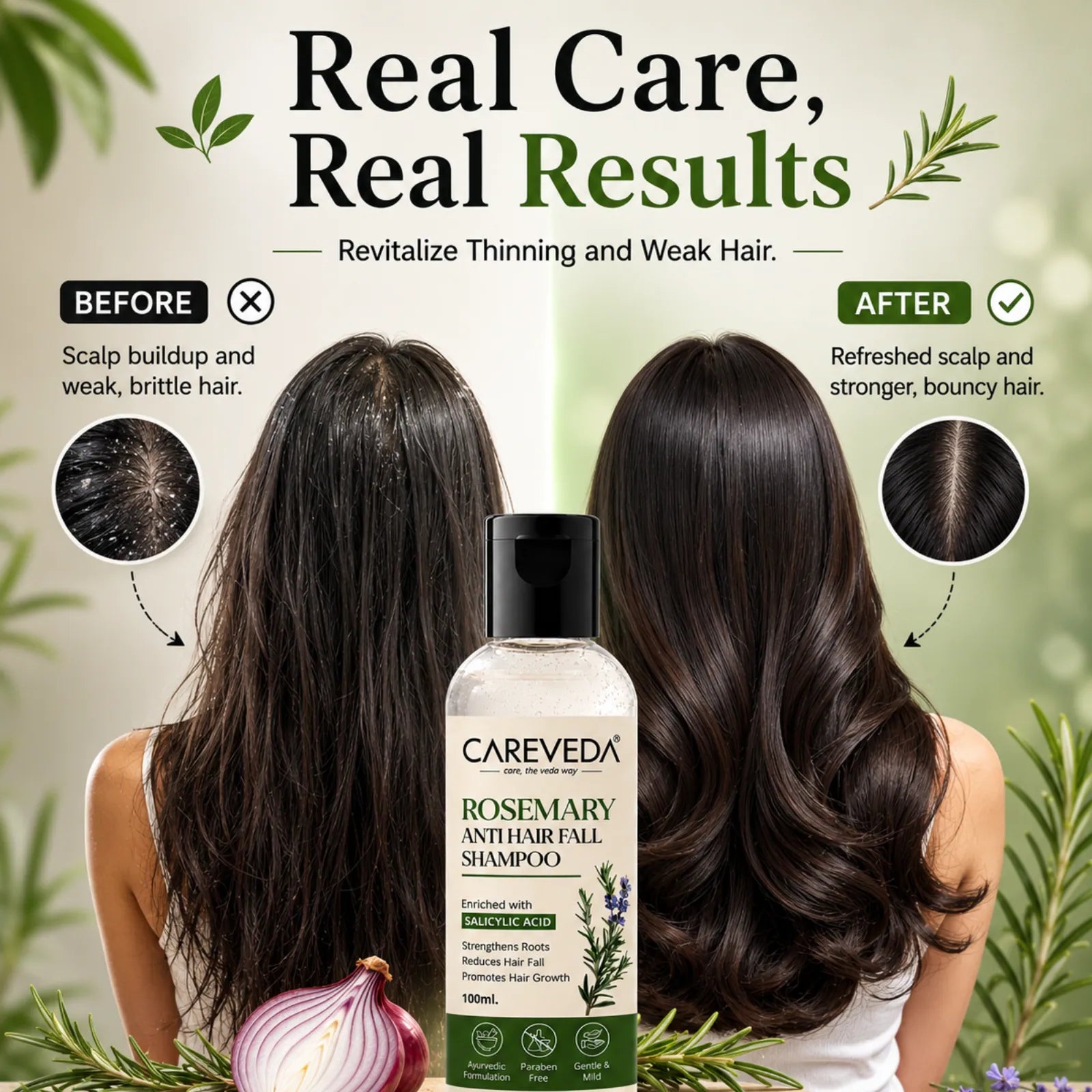 CareVeda Rosemary & Salicylic Acid Hair Growth Shampoo - Scalp Detox & Anti-Hair Fall Formula (100ml)