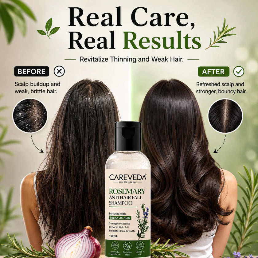 CareVeda Rosemary & Salicylic Acid Hair Growth Shampoo - Scalp Detox & Anti-Hair Fall Formula (100ml)